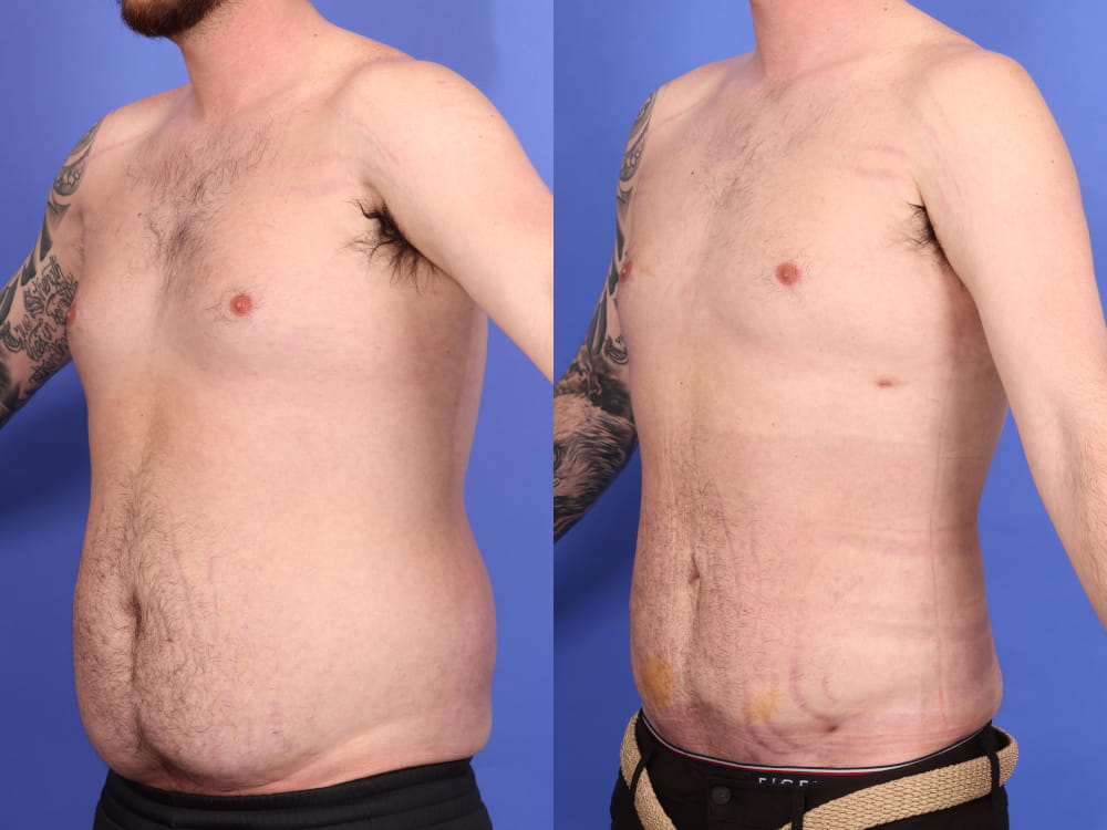 patient before and after