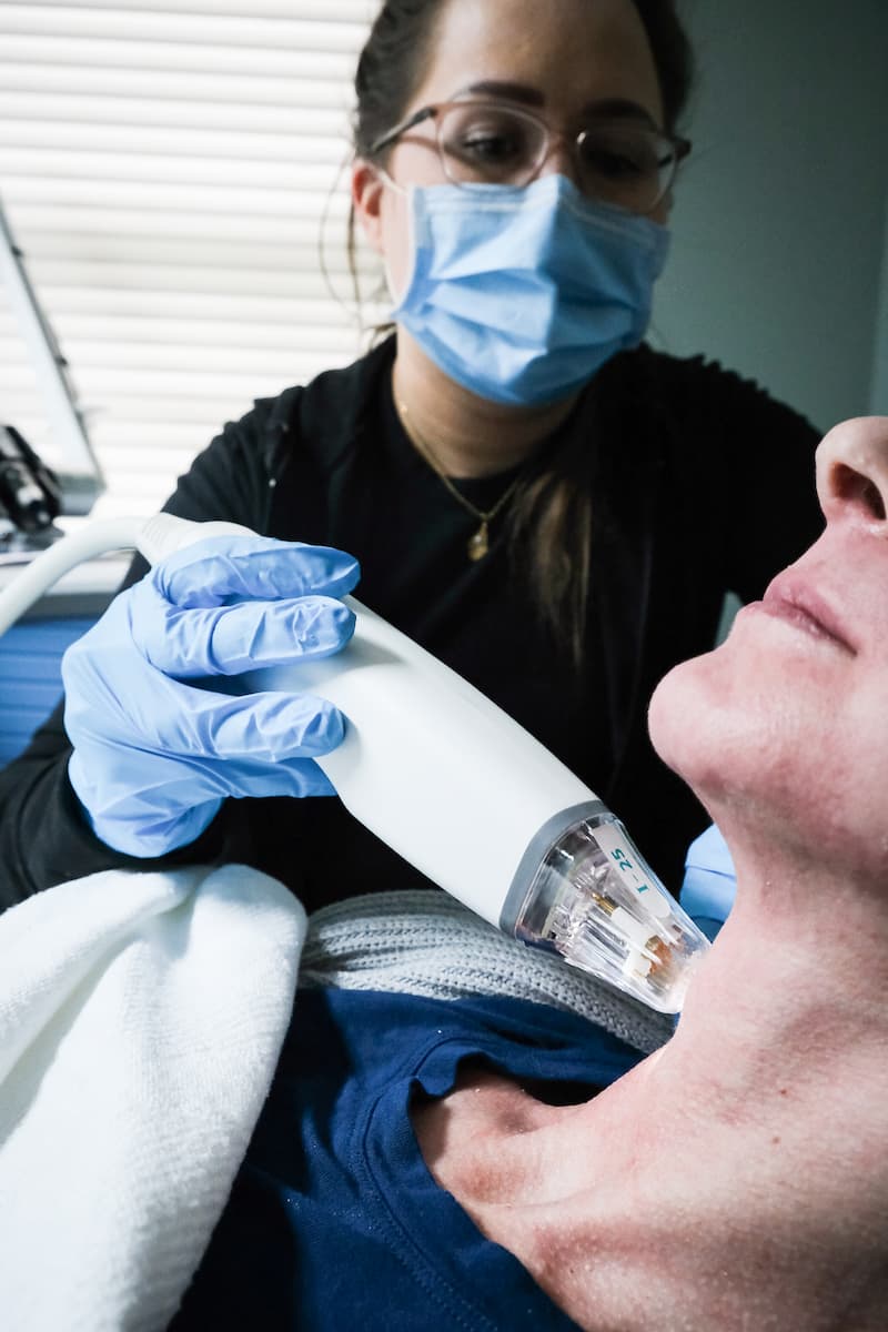 aesthetic professional using potenza non-surgical facelift device on a patient model