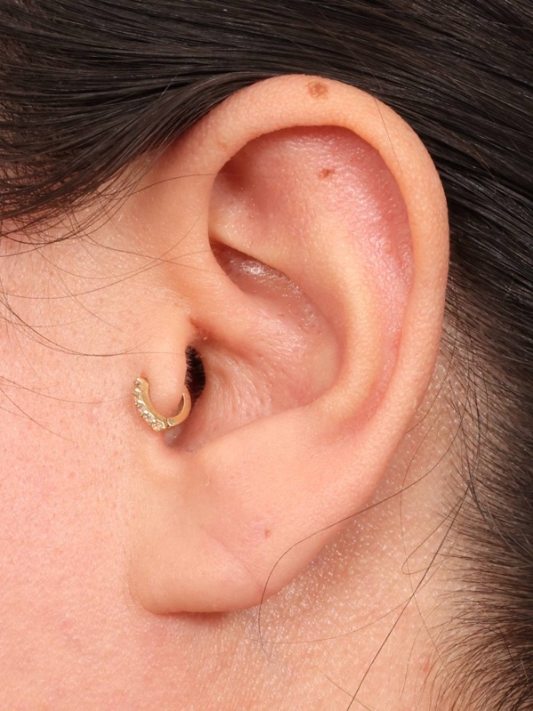 Earlobe Repair Before & After Image